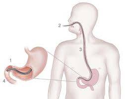 Gastroscopy - Gastroscopy Procedure